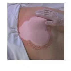 MEDICAZIONE IDROCELLULARE ADESIVA STERILE CONFORMATA PER LA REGIONE SACRALE ASSORBENTE IN SCHIUMA DI POLIURETANO ALLEVYN SACRUM 22,5X22,1CM 10PZ - Farmaspeed