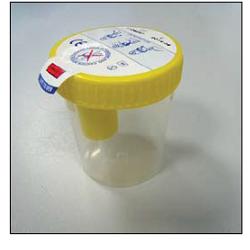 SECUR BOX URINE CONTAINER KIT YELLOW SCREW CAP WITH COLLECTION POINT 120 ML 1 PIECE